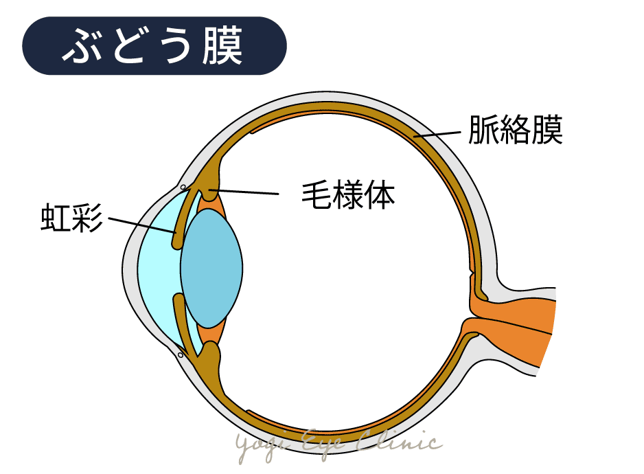ぶどう膜炎はどのように診断されますか?